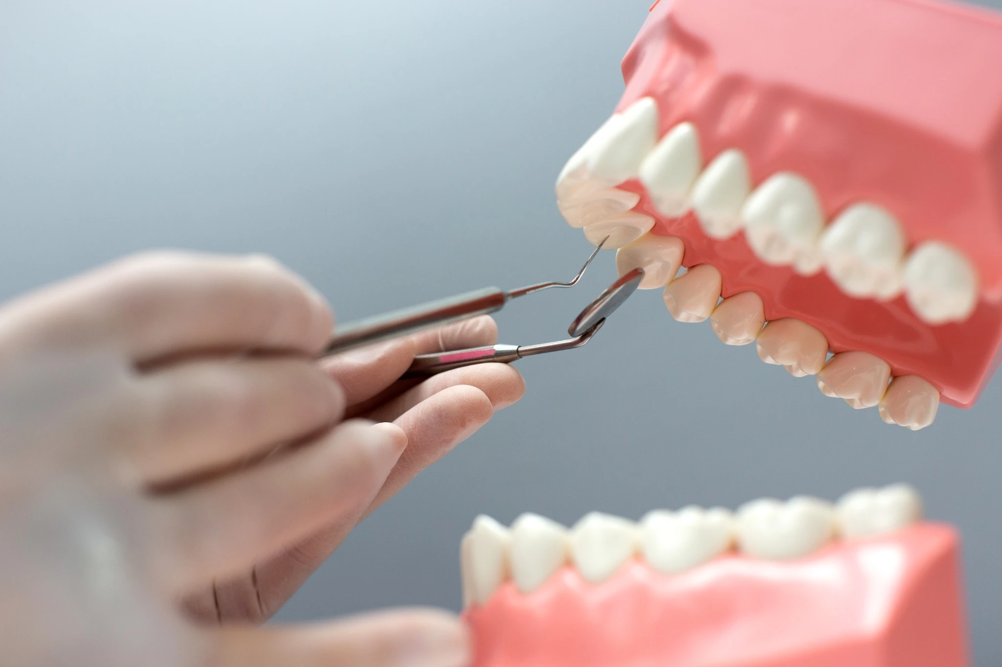 Teeth Reshaping