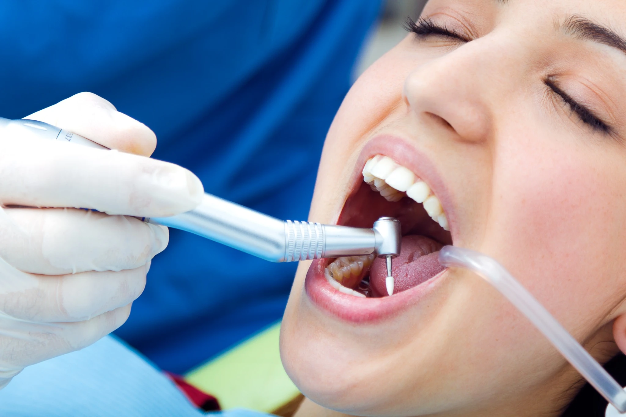 Teeth Whitening
